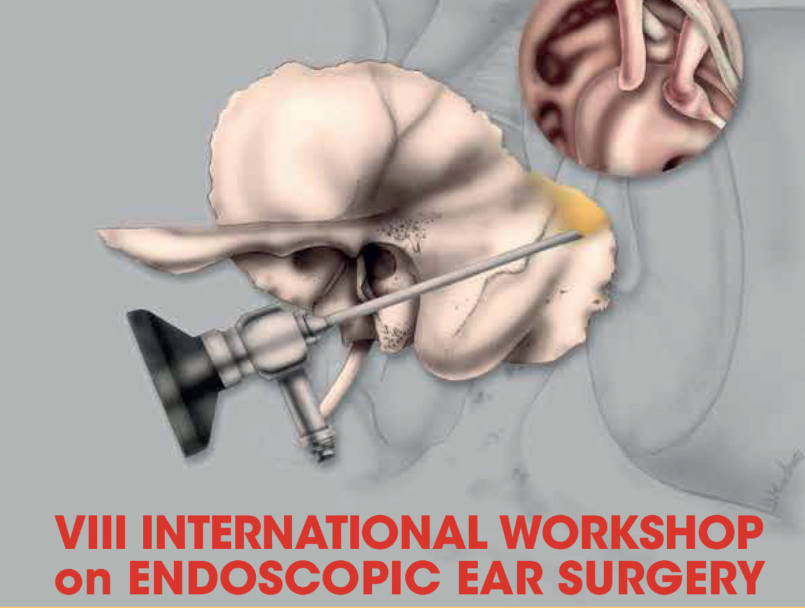VII international workshop on endoscopic ear surgery – Bologna e Modena – Dal 15 al 17 Maggio 2019