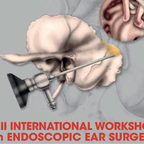 VII international workshop on endoscopic ear surgery – Bologna e Modena – Dal 15 al 17 Maggio 2019